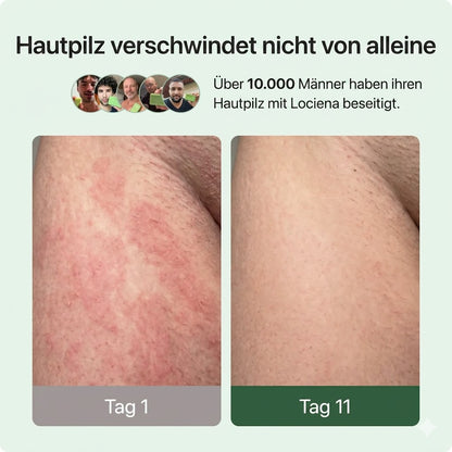 Lociena Anti-Pilz-Seife